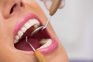 10 Simple Habits for Healthy Teeth and Gums